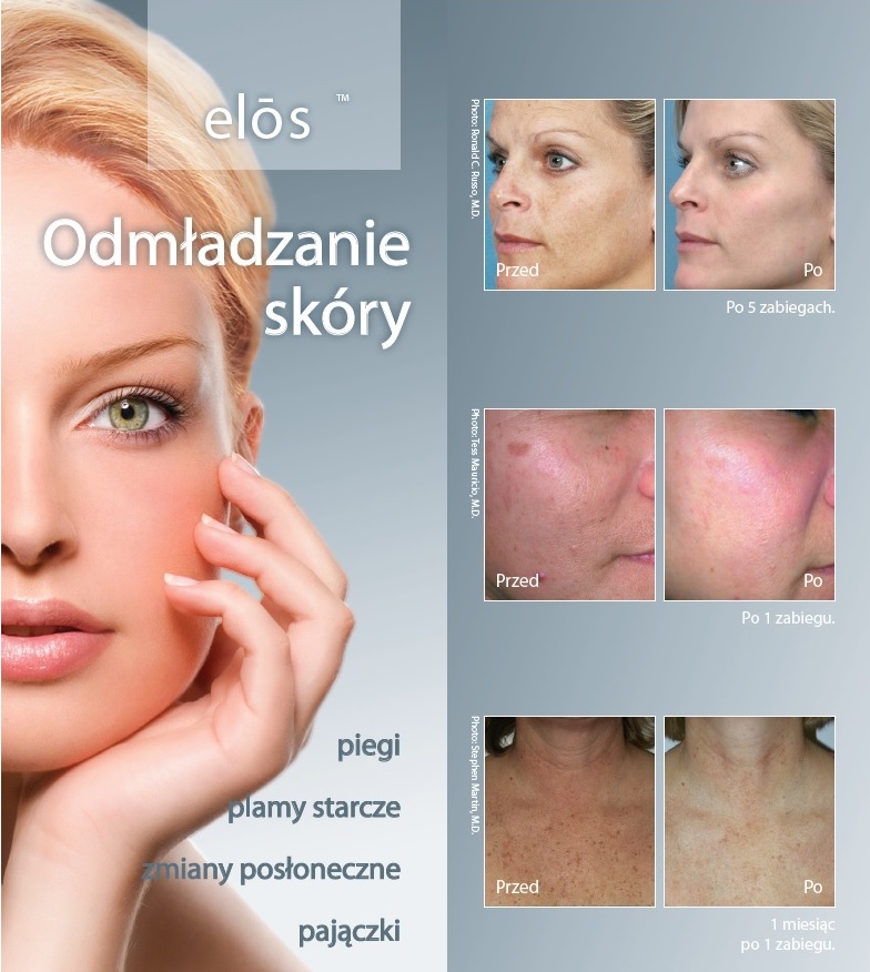 Gabinet Kosmetyczny Wrocław New Derm zabiegi laserowe